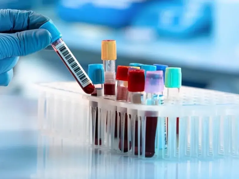 Serum Biochemistry Panel